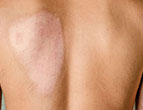skin small