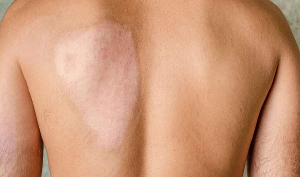 skin